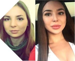 PHOTOS - See 90 Day Fiance's Anfisa Nava Before Plastic Surgery