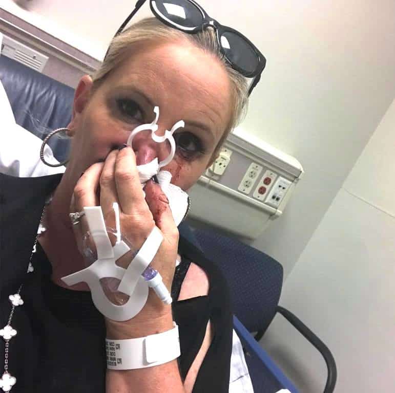 Shannon Beador Hospital Nose Bleed