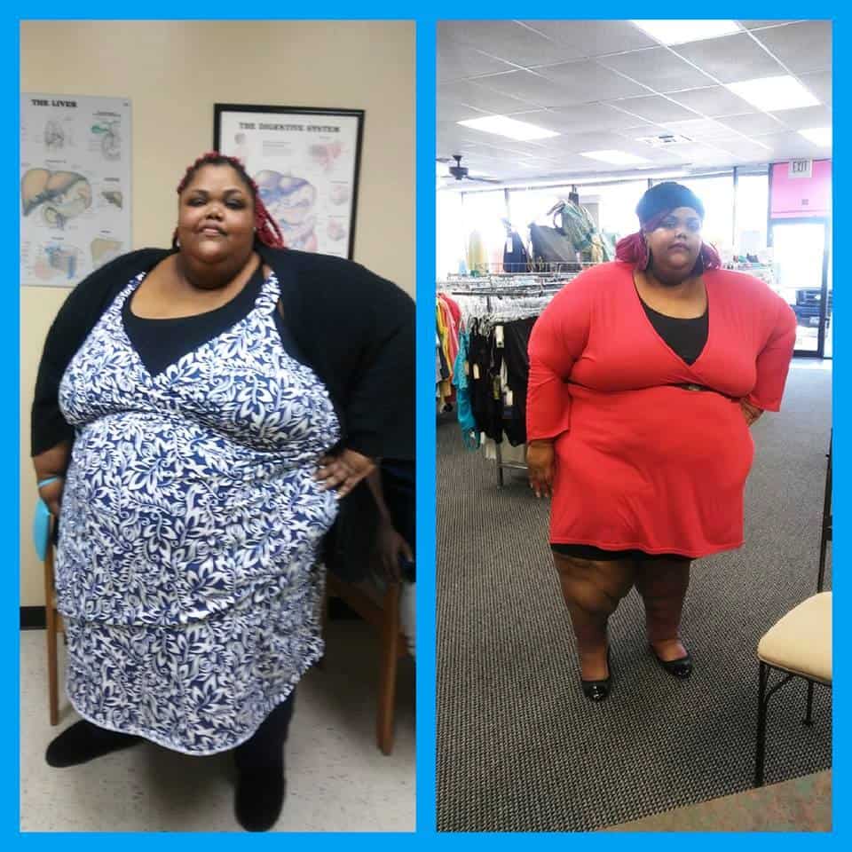 My 600 Lb Life Roshanda Perrio Before and After Photo