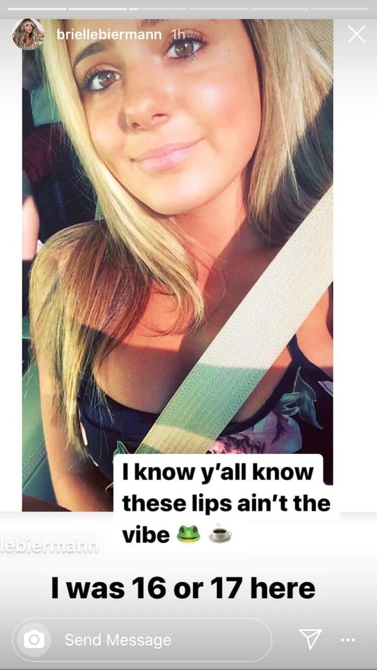 PHOTOS: Brielle Biermann Gets Rid of Her Lip Fillers as Ex Michael