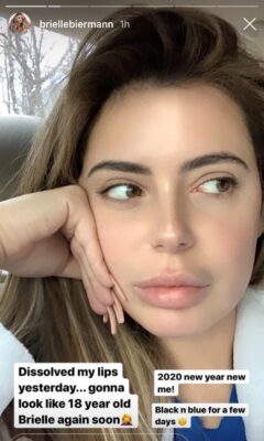 PHOTOS: Brielle Biermann Gets Rid of Her Lip Fillers as Ex Michael Weds