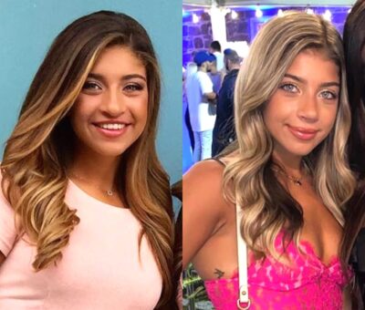 PHOTO: Gia Giudice Shares a Picture of Her Nose Job, See Before and