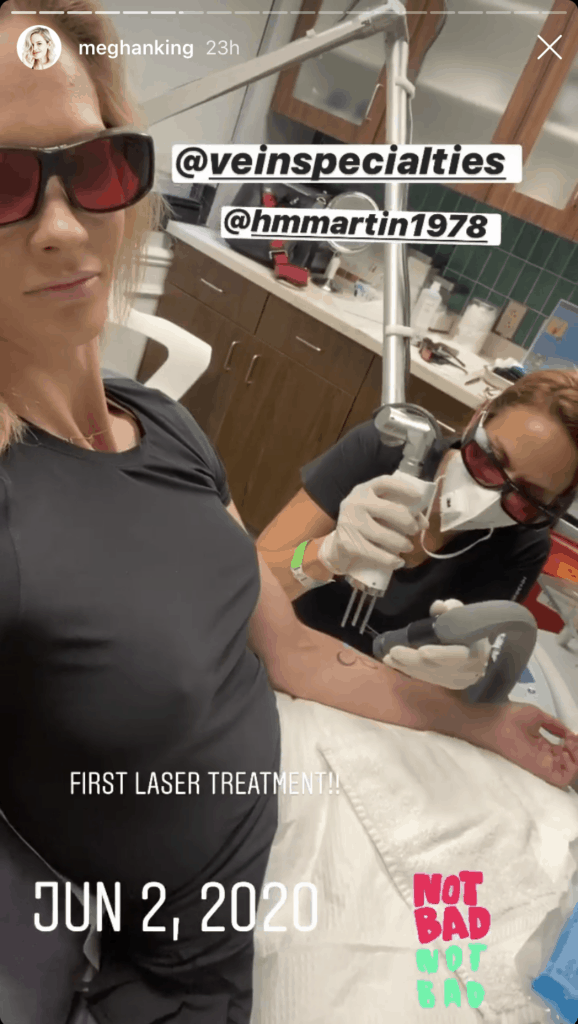 PHOTOS: Meghan King Removes Tattoo of Ex Jim Edmonds After Messy Split