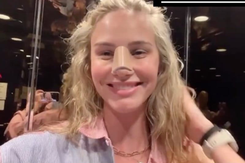 Meghan King In Nose Splint RHOC Meghan King In Nose Splint