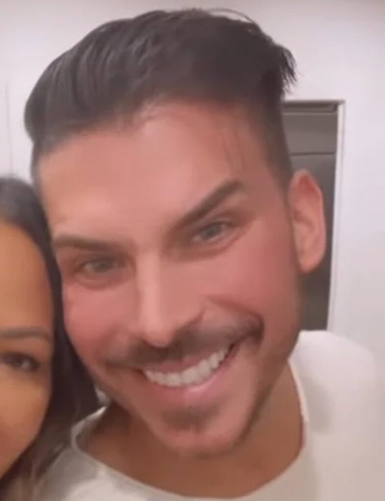 jax taylor plastic surgery Image 7