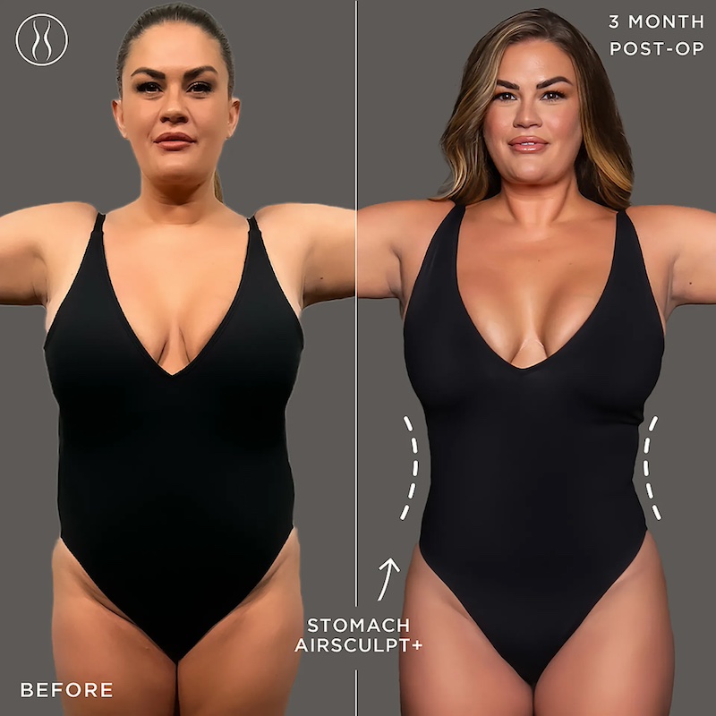 The Valley Brittany Cartwright Before And After Airsculpt Front copy