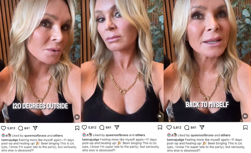 RHOC Tamra Judge Debuts New Face After Brow Lift