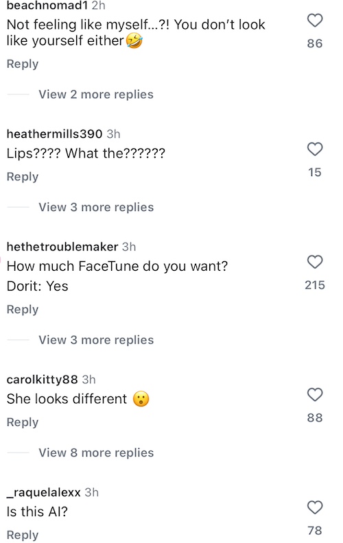 RHOBH Dorit Kemsley is Called Out for Odd Lips and FaceTune