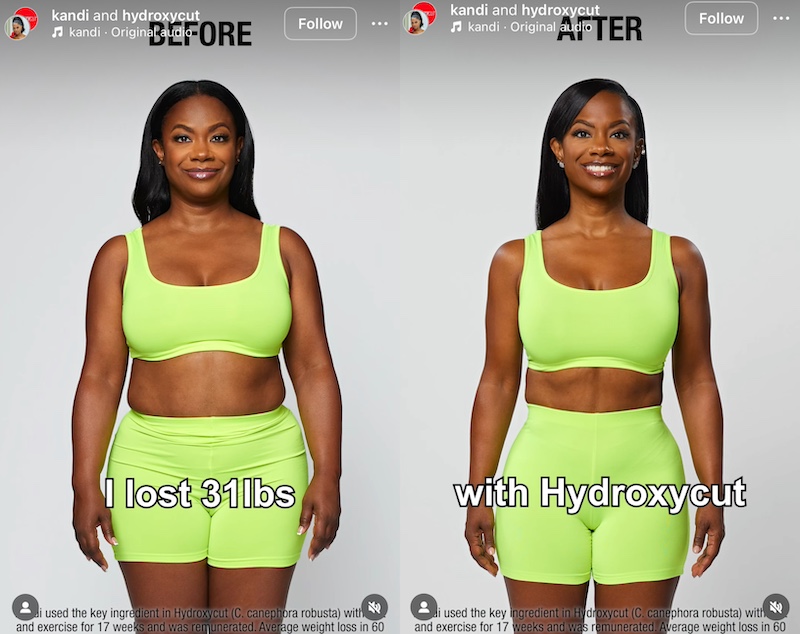 RHOA Kandi Burruss Shows Off 31 Pound Weight Loss