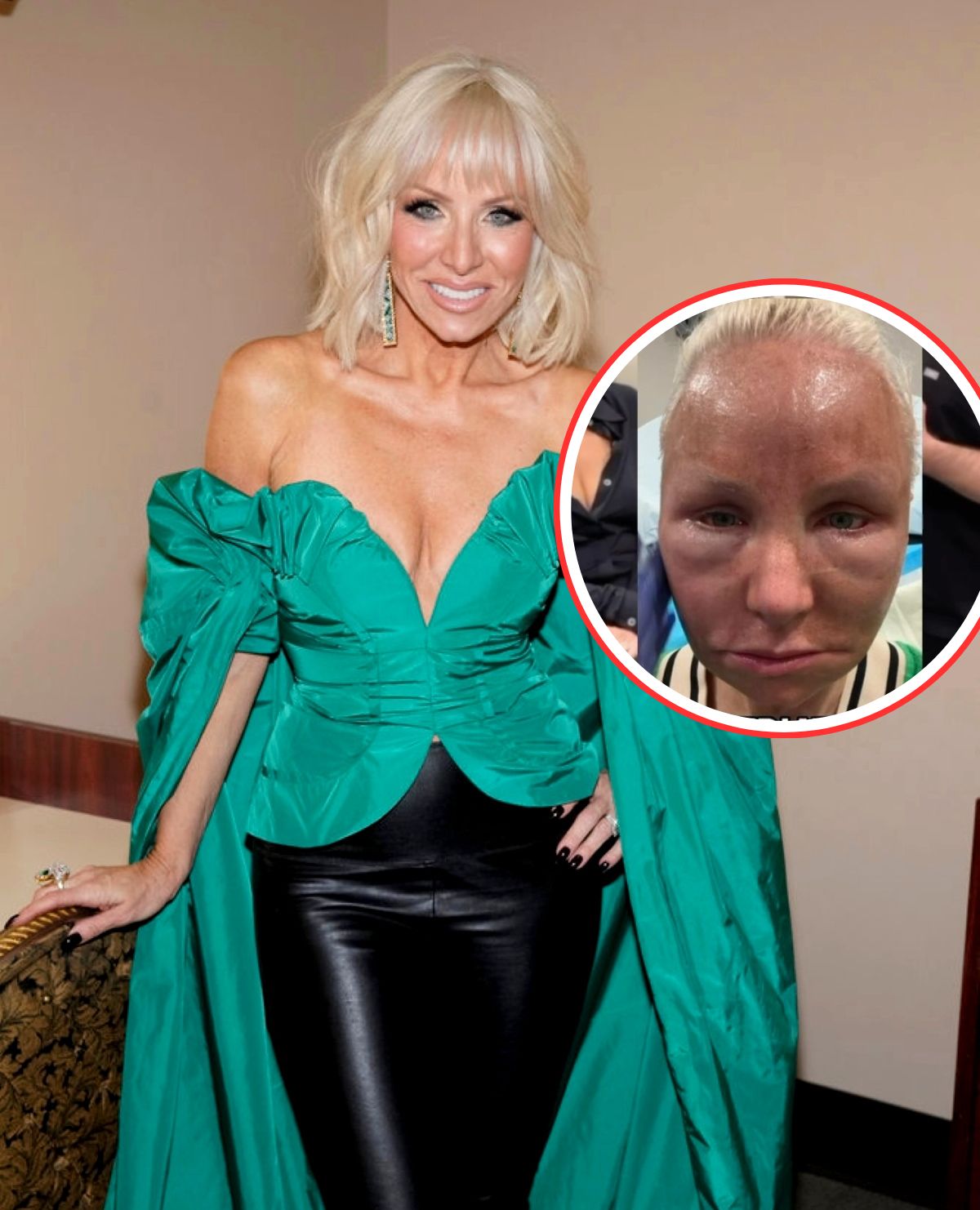  Margaret Josephs Shows Before & After Pics of CO2 Laser Treatment as She Details "Monstrous" Procedure and Shares Why She Did It, Plus RHONJ Costars & Dorinda React