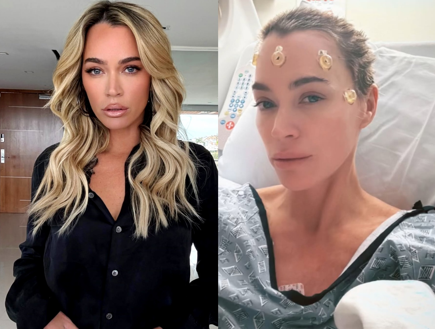 RHOBH’s Teddi Mellencamp Defends Going Horseback Riding After Brain Surgery and Thanks Dad John Mellencamp for His Support