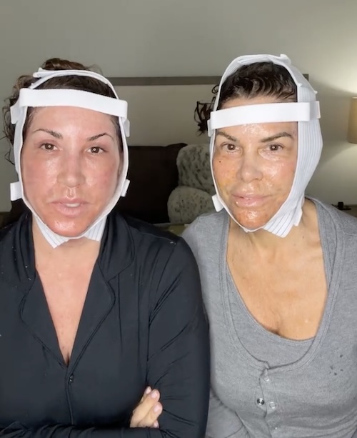 RHONJ Jacqueline laurita and Lynn Curtin After Facelift and Neck Lifts