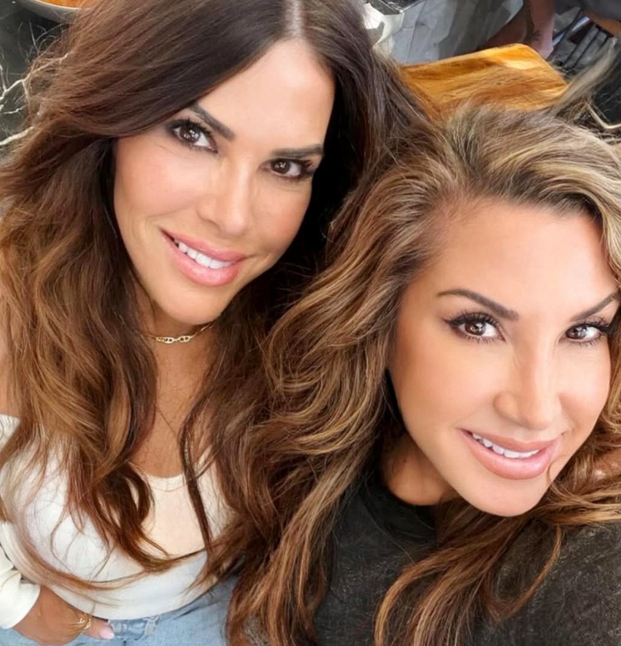 RHONJ’s Jacqueline Laurita Undergoes Facelift and Neck Lift With Lynne Curtin, Shares Post-Surgery Update as They Claim It “Doesn’t Even Hurt”