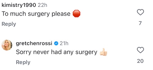 RHOC Gretchen Rossi Denies Having Too Much Plastic Surgery