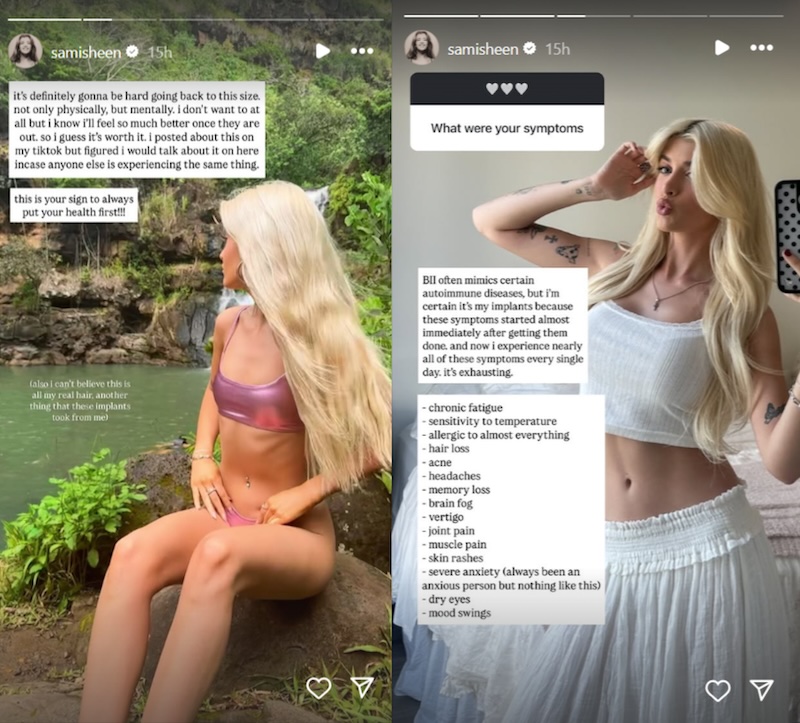 RHOBH Sami Sheen Explains Breast Implant Illness Symptoms