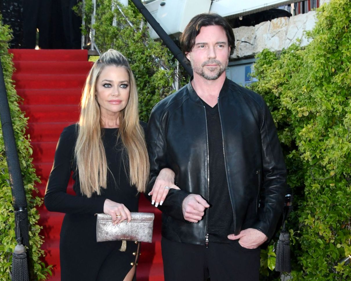 PHOTOS: Denise Richards Accuses Aaron Phypers of Horrifying Abuse and Threatening to Kill Her as RHOBH Alum Shares Pics of Her Injuries & is Granted Restraining Order
