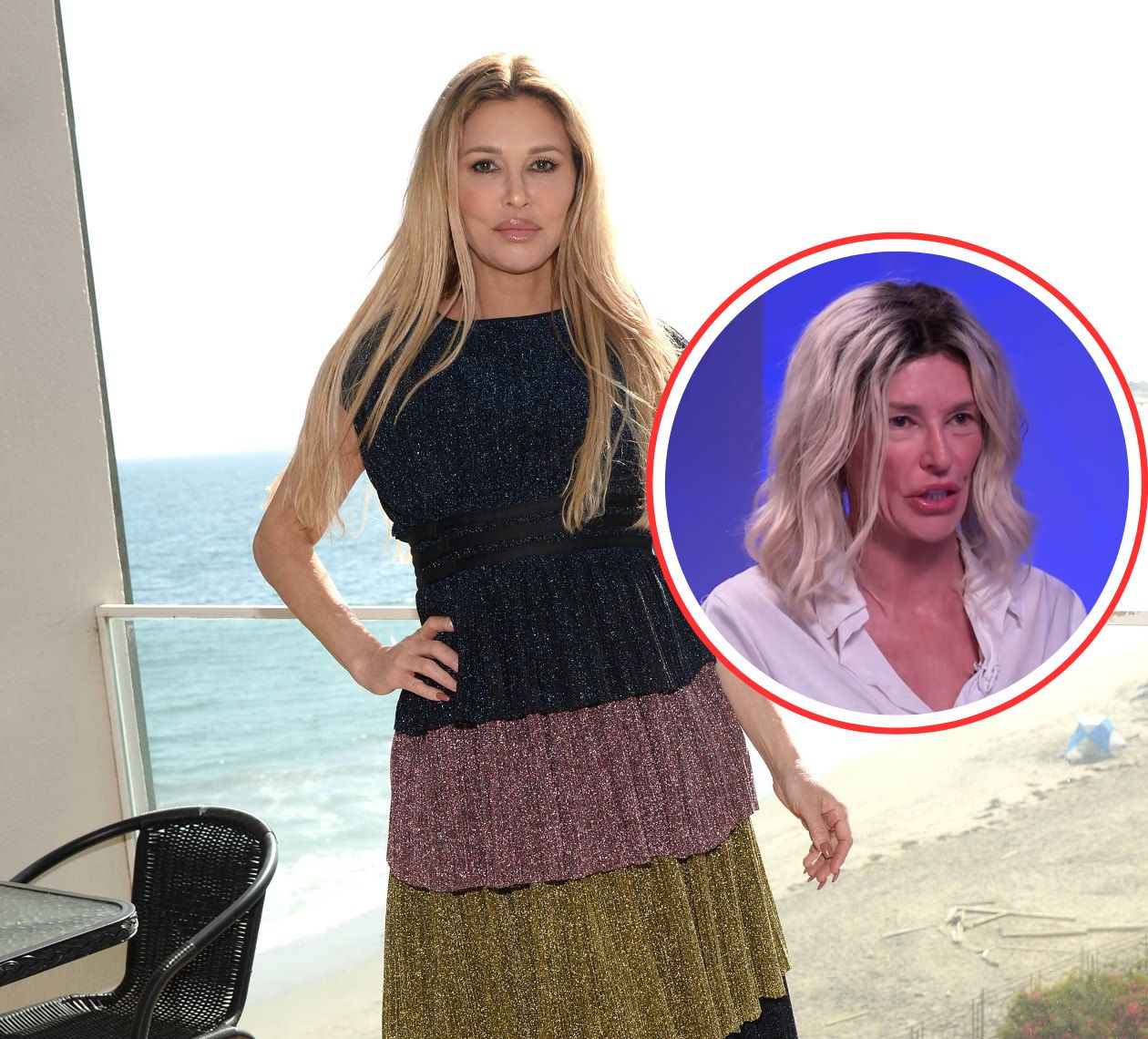 RHOBH's Brandi Glanville Shares Update on Facial “Parasite” After Spending Over $100K Amid Facial Disfigurement, Talks Suicidal Thoughts, Financial Fears and New Treatment Plan
