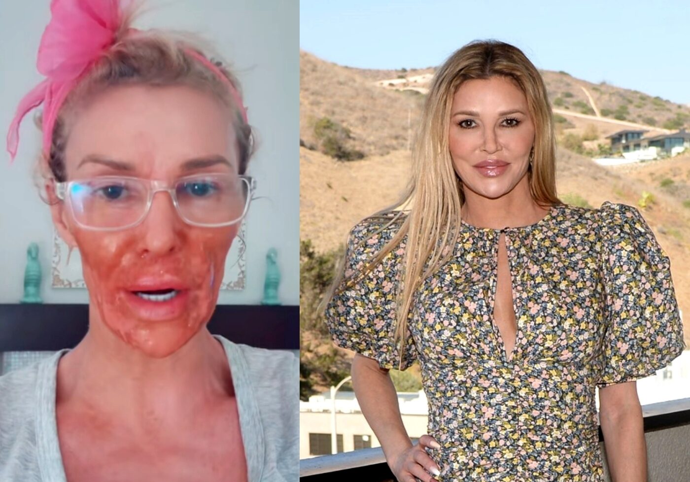 VIDEO: Brandi Glanville Burns Face With Nair Amid Battle With Facial  Parasite 'Caroline' in Bizarre TikTok