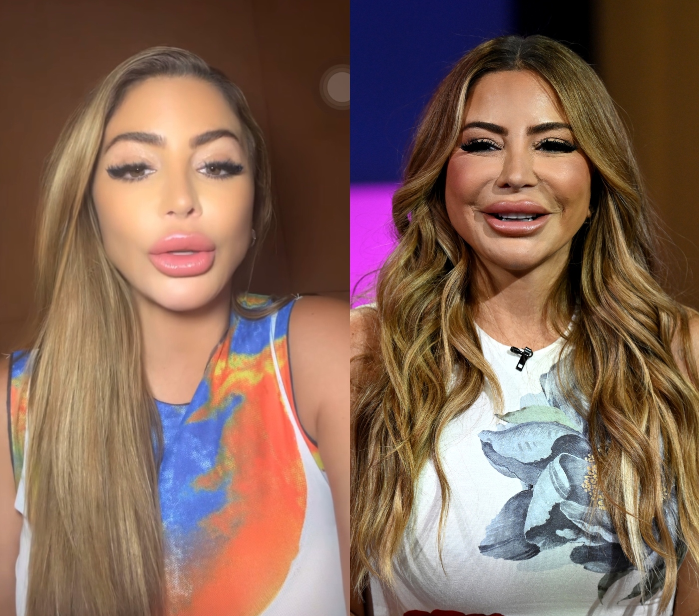 RHOM Star Larsa Pippen Suggests Viral Photo of Her Was Altered as Dr. Jen Armstrong Denies Her Claim That an Allergic Reaction Caused Facial Swelling