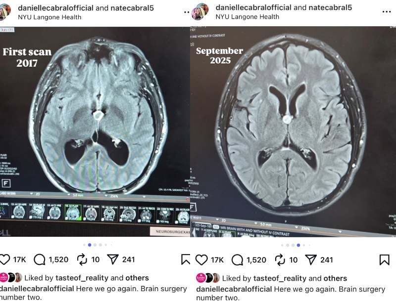 RHONJ Danielle Cabral Husband Nate Brain Scans