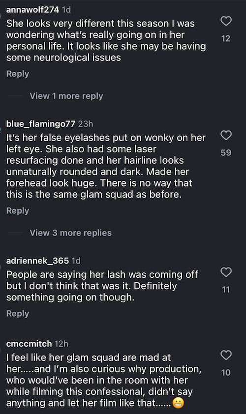 RHOSLC Lisa Barlow Sparks Black Eye Rumors on RHOSLC Season 6 Episode 2