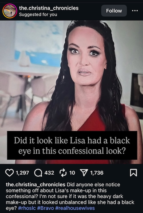 RHOSLC Fans Suspect Lisa Barlow Has Black Eye in Season 6 Confessional