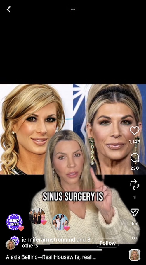 Dr Jennifer Armstrong Accuses Alexis Bellino of Plastic Surgery