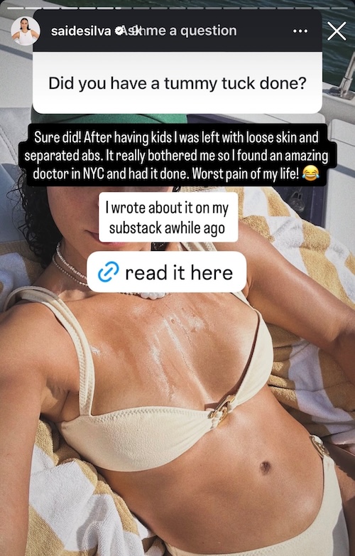 RHONY Sai De Silva Confirms Tummy Tuck