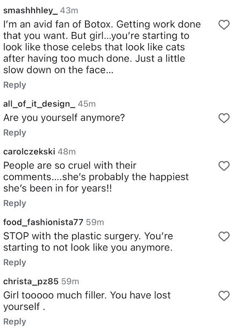 The Valley Brittany Cartwright Accused of Having Plastic Surgery and Too Much Filler