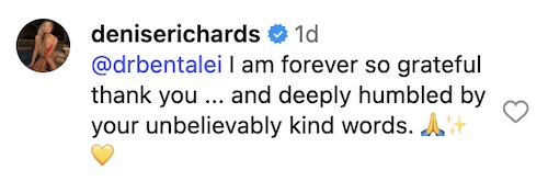 RHOBH Denise Richards Reacts to Doctor Speaking of Face Lift