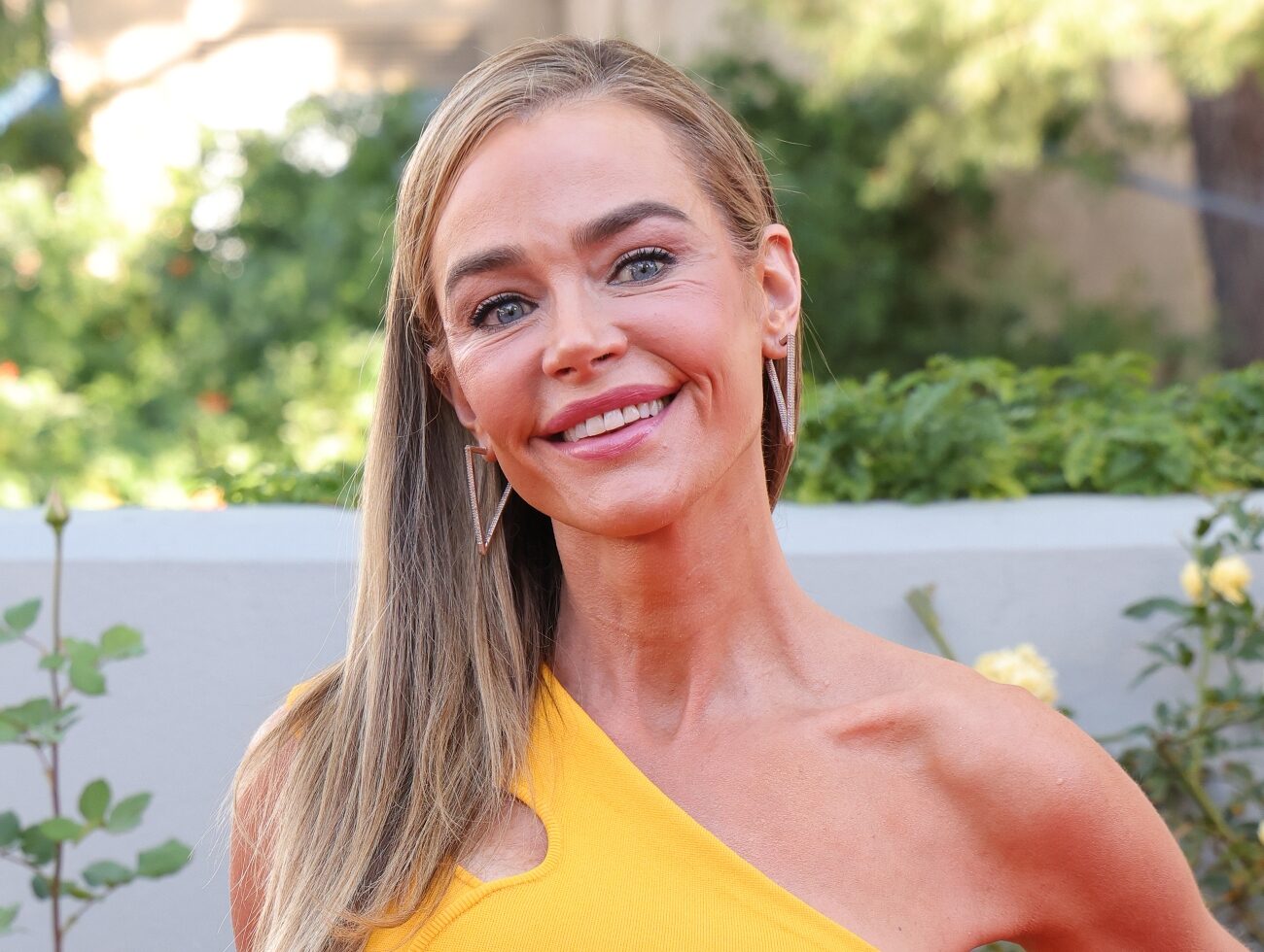 Denise Richards Shares Before and After Pics of Facelift as She Discusses Daughters’ Reaction