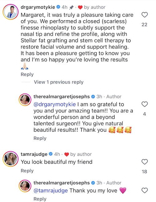 RHONJ Margaret Josephs Thanks Plastic Surgeon After Nose Job