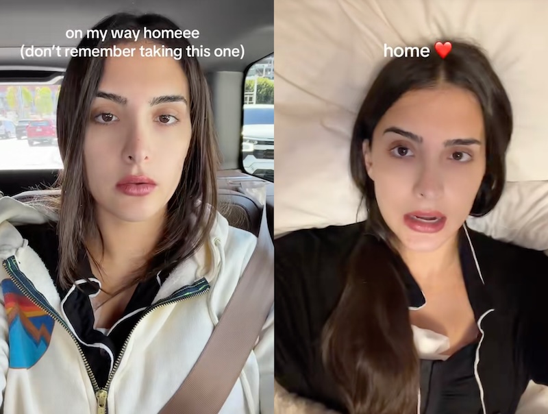 RHOBH Sophia Umansky After Breast Lift