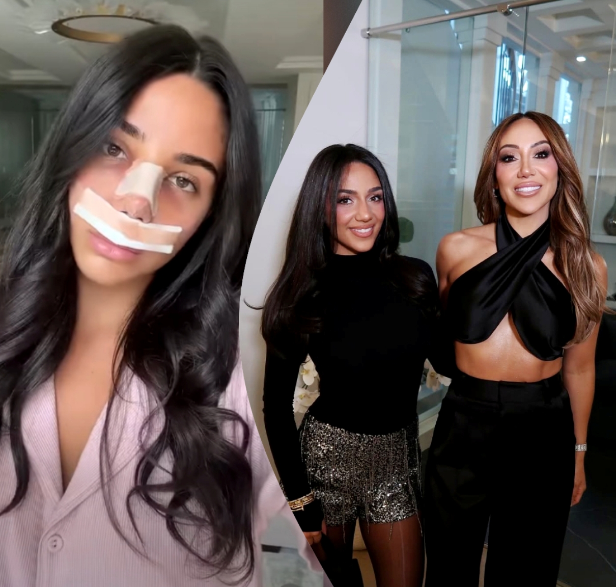 PHOTO: RHONJ's Antonia Gorga Confirms She Got a Nose Job as Mom Melissa and RHONJ Stars React