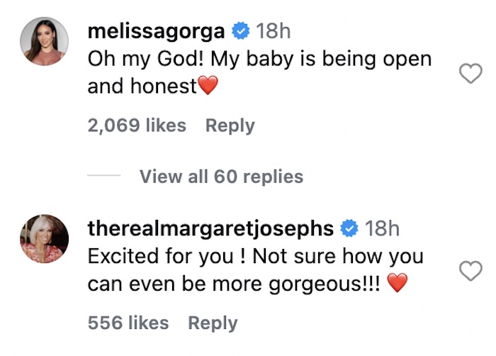 RHONJ Melissa Gorga and Margaret Josephs React to Antonia Gorga's Nose Job
