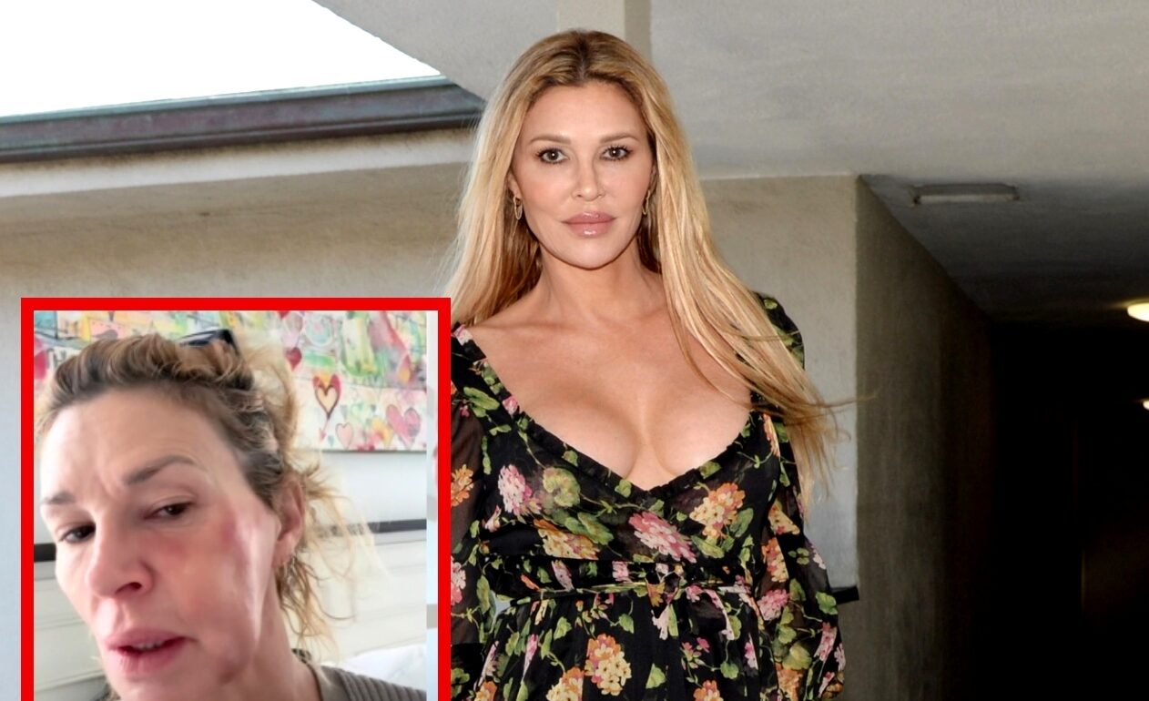 Brandi Glanville's Health Crisis Leaves Her Struggling Financially Amid Ongoing Treatment