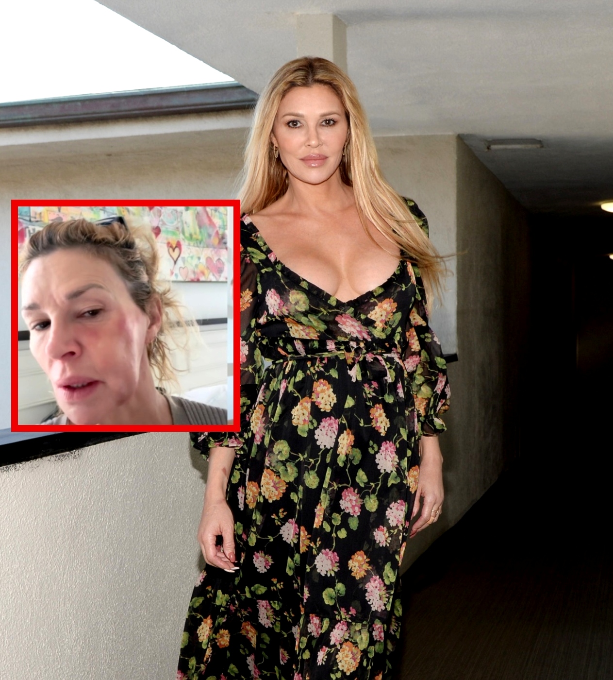 'RHOBH' Alum Brandi Glanville's Friend Starts GoFundMe for Her to Help Pay Her Medical Bills Amid Ongoing Health Crisis