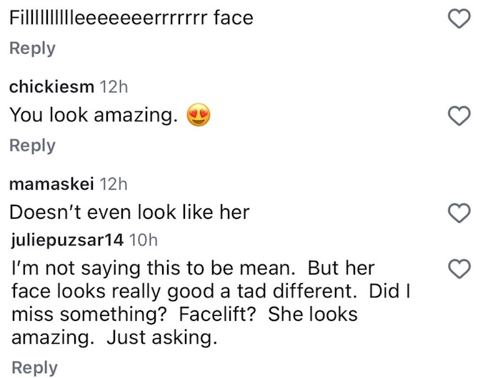 RHOSLC Meredith Marks Called Out for Filler